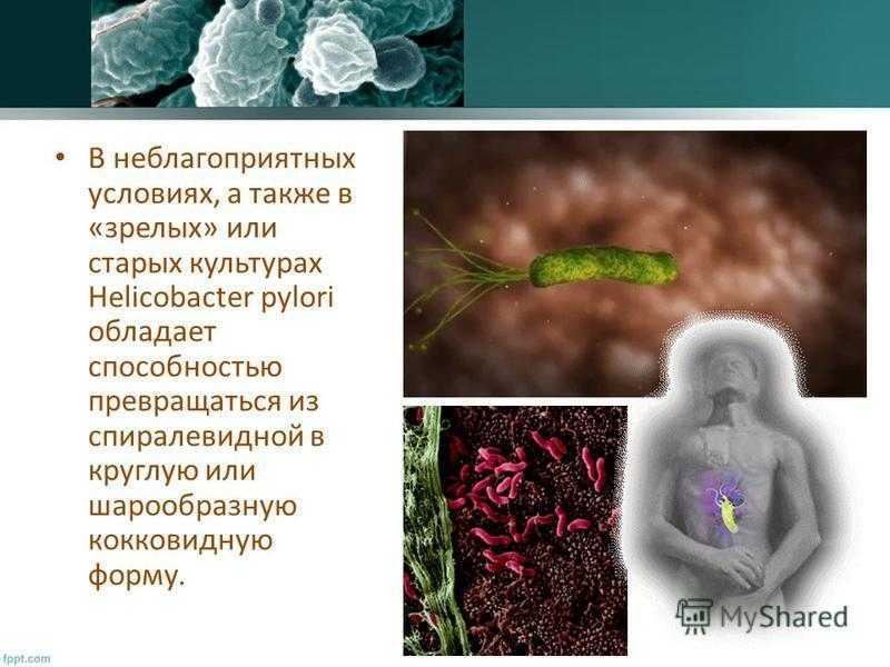 Благоприятные и неблагоприятные условия для роста helicobacter pylori | стимбифид плюс