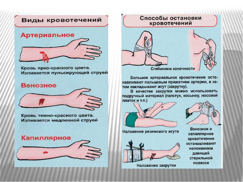 Способы завершения грудного вскармливания - agulife.ru