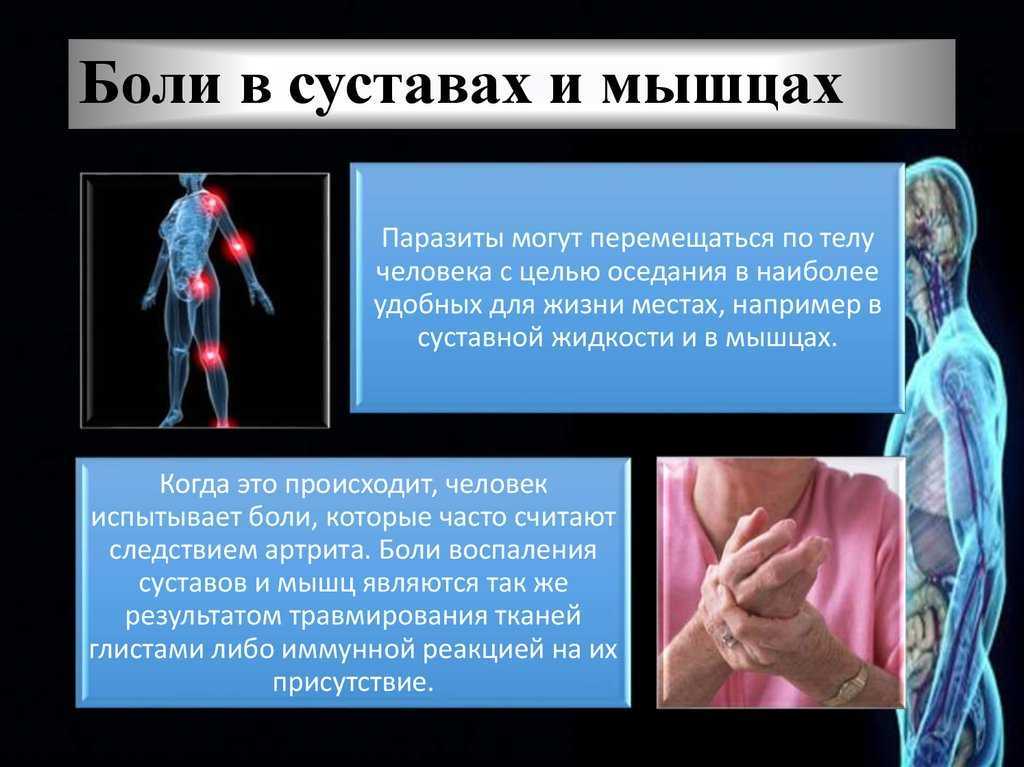 Заболевание мышц лечение