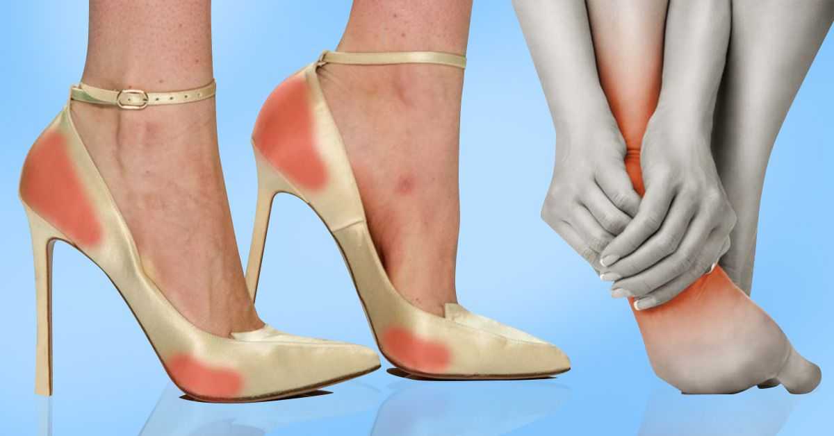 Реальный вред высоких каблуков для здоровья: правда или вымысел?