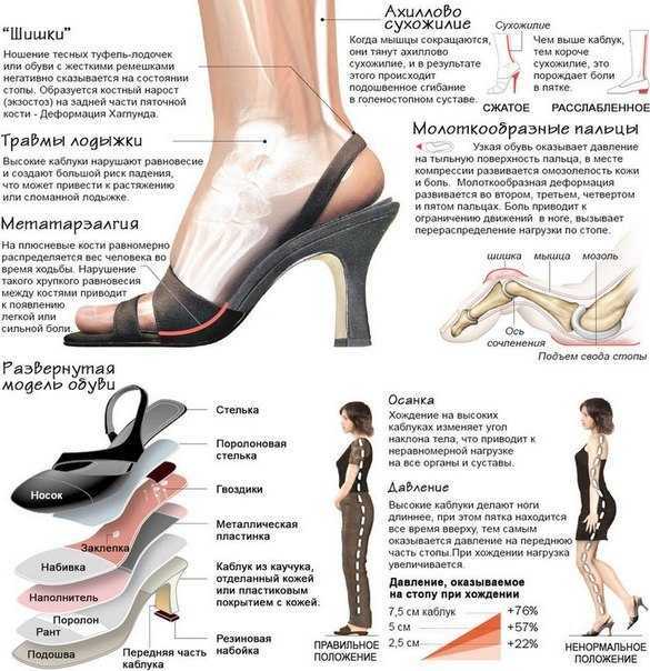 Влияние высокого каблука на здоровье ног — womanwiki - женская энциклопедия